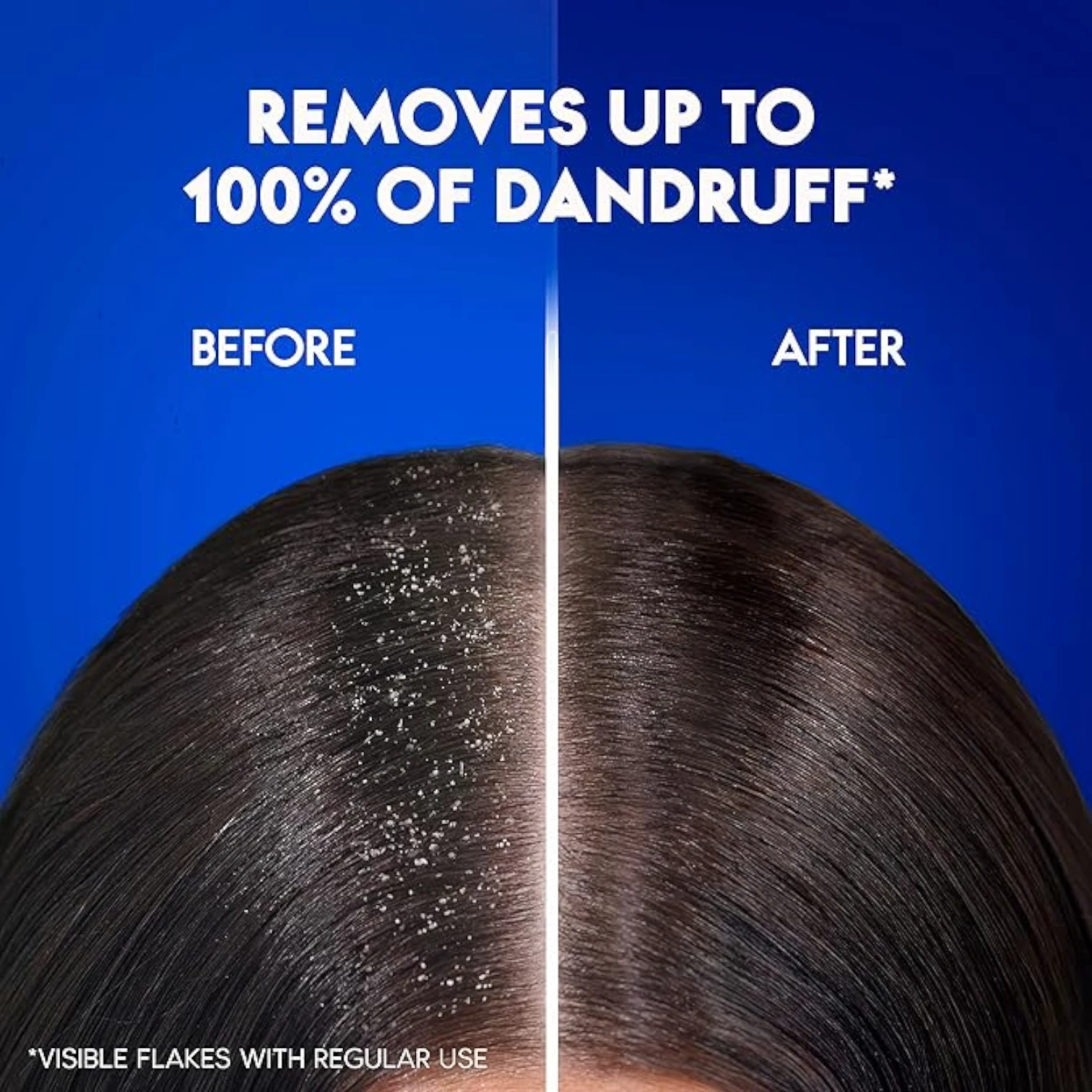 Head & Shoulders Menthol Refresh Anti-Dandruff Shampoo – Cooling Relief for Itchy Scalp with Natural Menthol – 400ml - Damoo