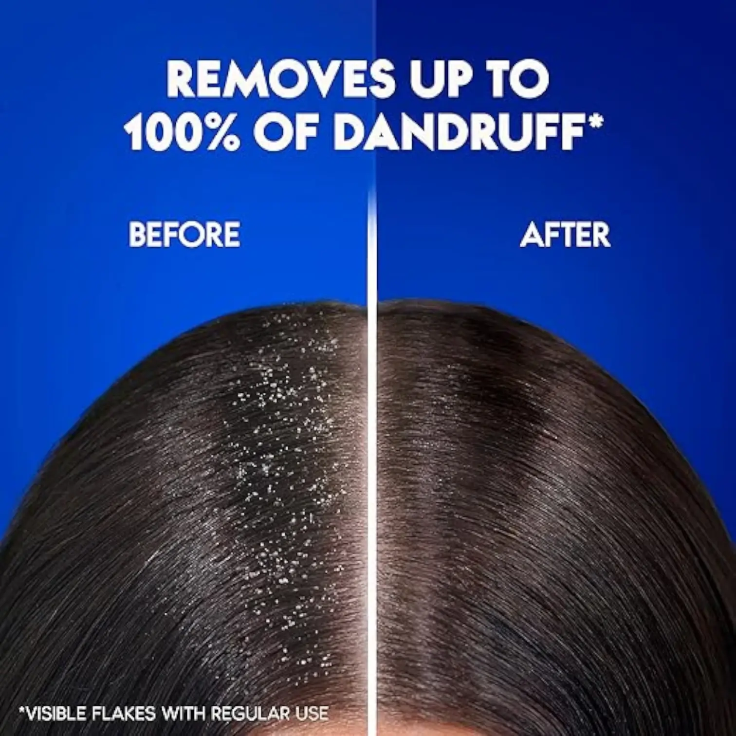 Head & Shoulders Smooth & Silky Anti-Dandruff Shampoo 1000ml – For Dry, Frizzy Hair | 24-Hour Moisture | Clinically Proven | pH Balanced | For All Hair Types - Damoo