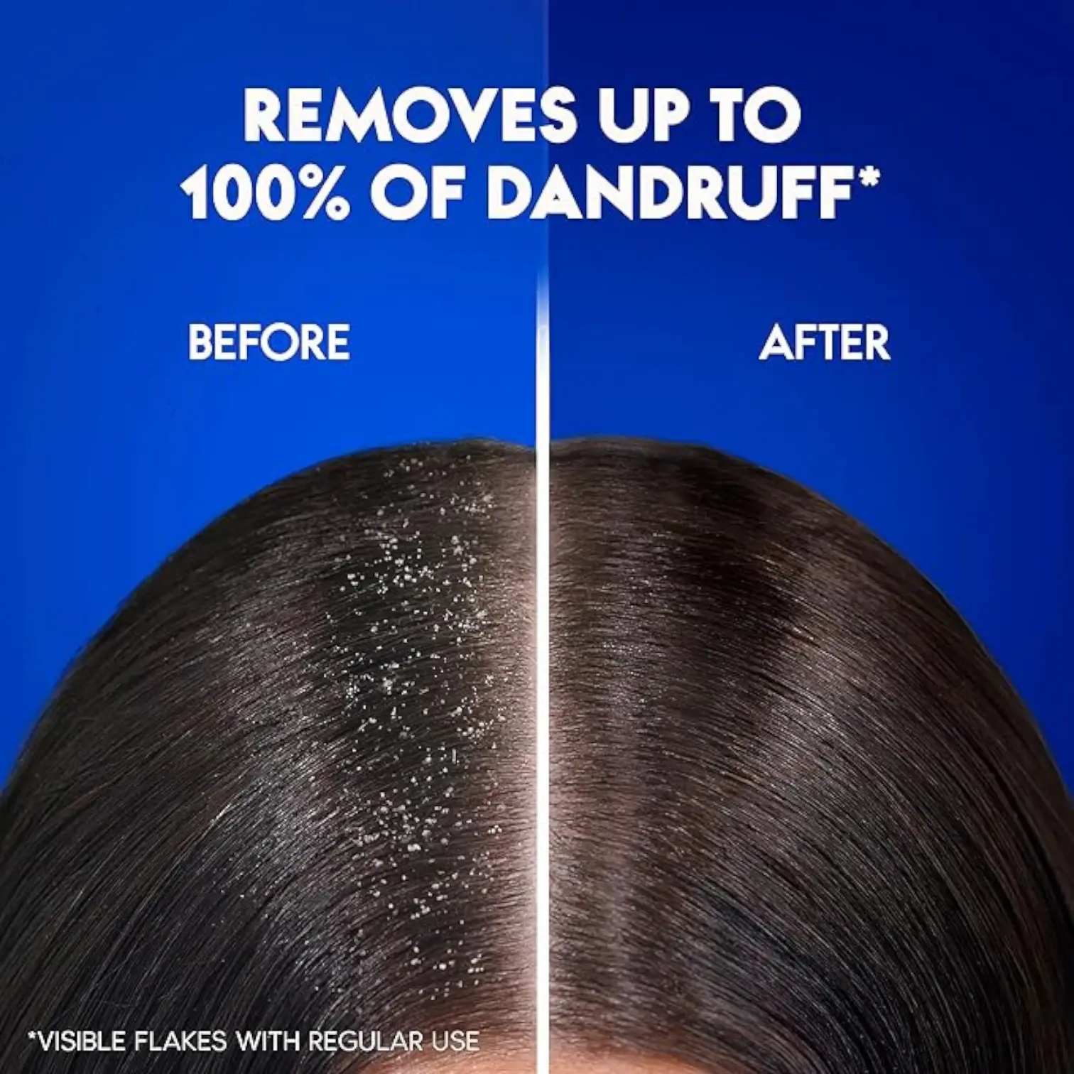 Head & Shoulders Extra Volume Anti-Dandruff Shampoo – 400ml – For Fine, Limp Hair – 24H Volume Boost & Dandruff Control - Damoo