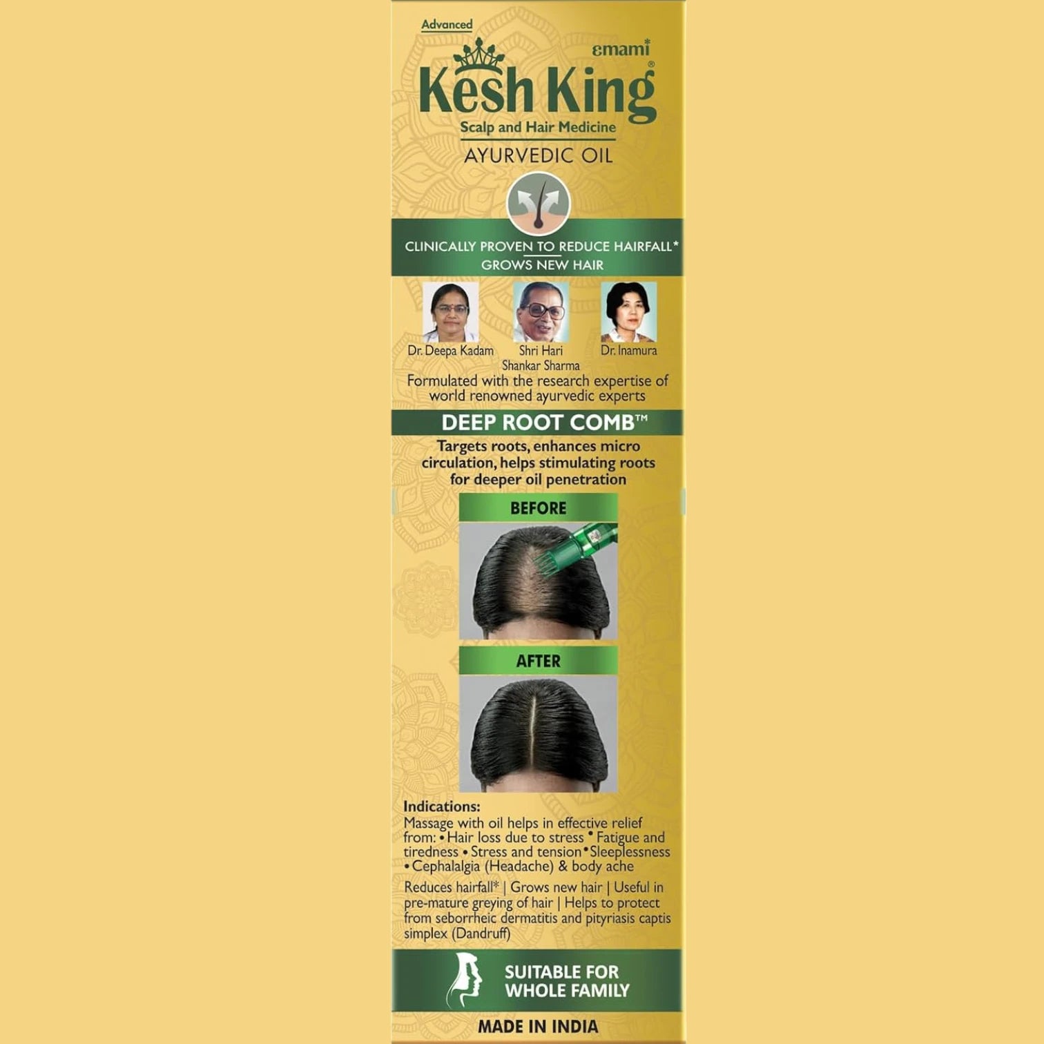 KESH KING Ayurvedic Anti Hairfall Hair Oil – 300ml | Herbal Hair Growth & Fall Control Treatment | Paraben-Free | For All Hair Types - Damoo