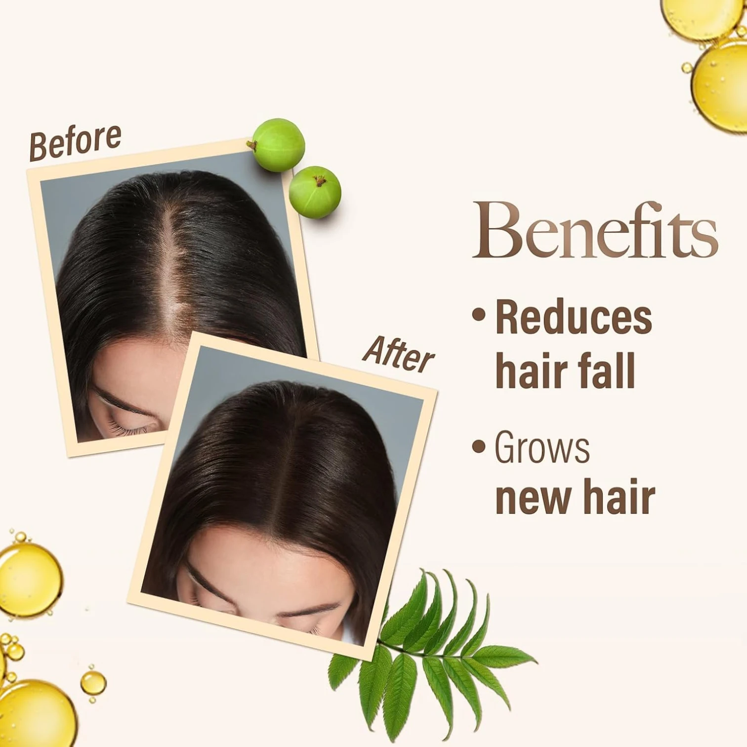 KESH KING Ayurvedic Anti Hairfall Hair Oil – 300ml | Herbal Hair Growth & Fall Control Treatment | Paraben-Free | For All Hair Types - Damoo