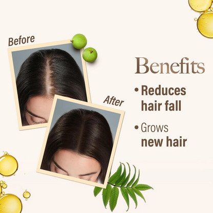 KESH KING Ayurvedic Anti Hairfall Hair Oil – 300ml | Herbal Hair Growth & Fall Control Treatment | Paraben-Free | For All Hair Types - Damoo
